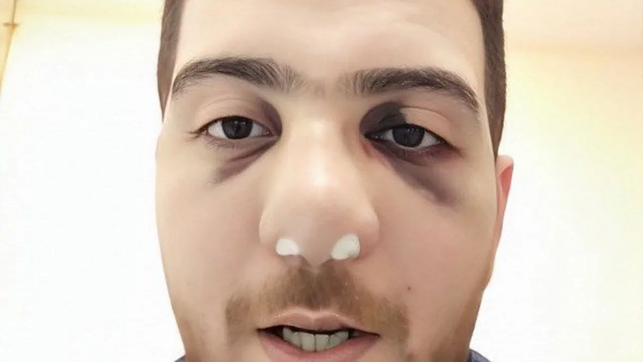 أدلة جديدة.. تفاصيل صادمة في واقعة اعتداء طبيب المنوفية بمستشفى الباجور العام